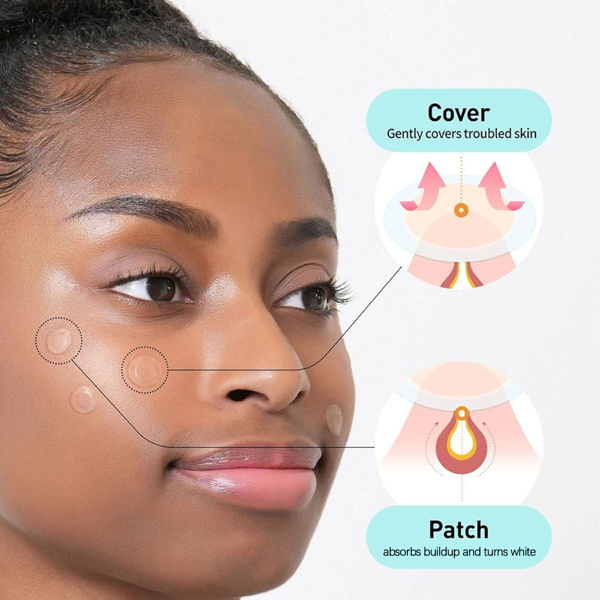 Parches para Cubrir Manchas Ol - Skincare Acne reseña y precio