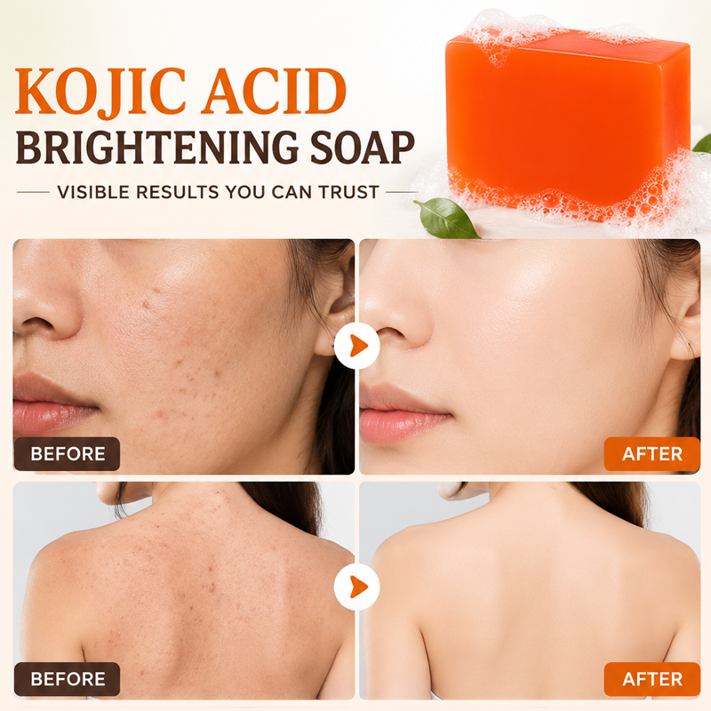 Jabón de Ácido Kójico, Paquete - Kojic Acid Soap reseña y precio