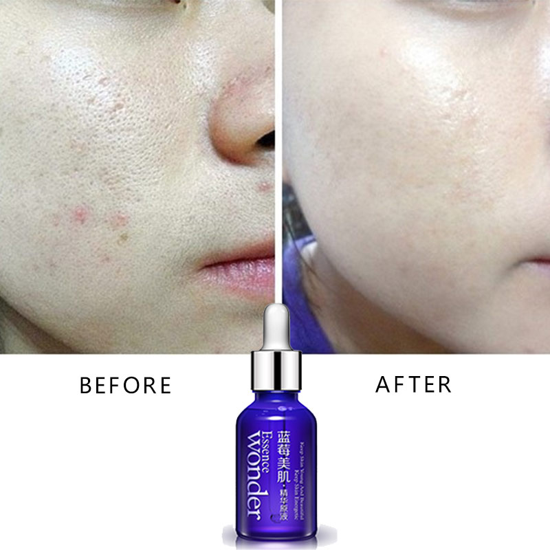 BIOAQUA-suero de Lifting facia - Skincare Garnier reseña y precio