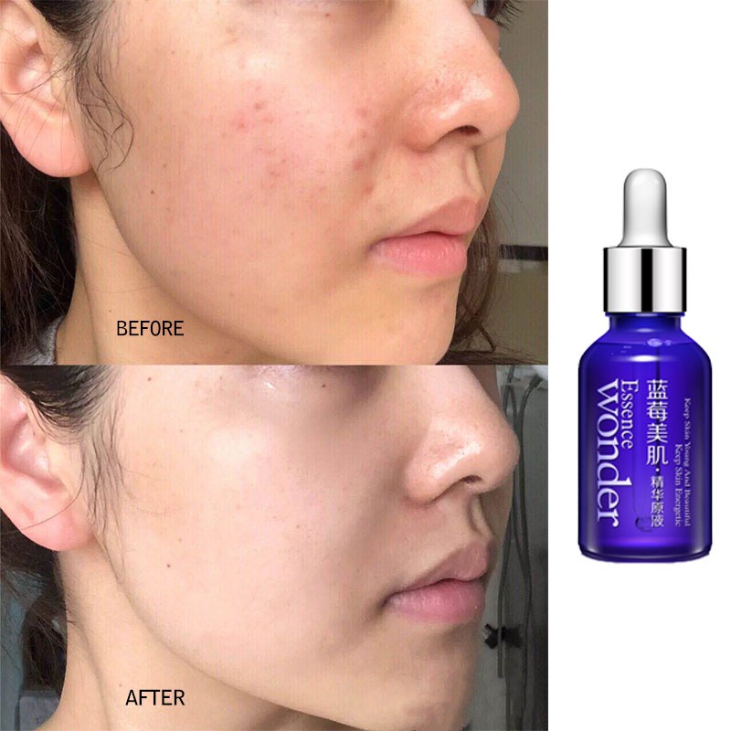 BIOAQUA-suero de Lifting facia - Skincare Garnier reseña y precio